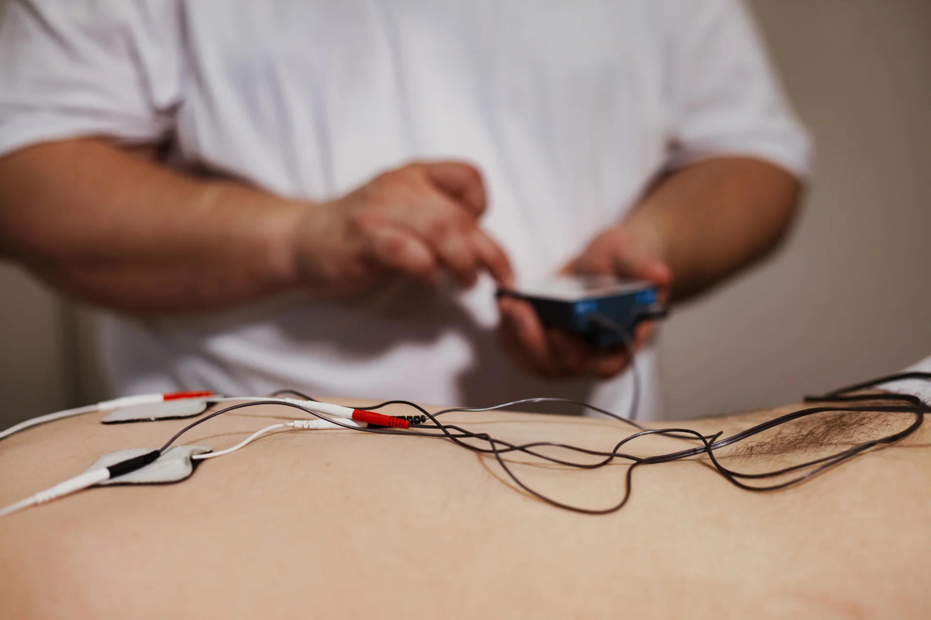 Electroacupuncture Variations